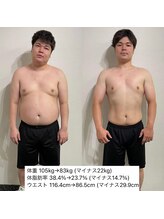 ビヨンド 札幌大通店(BEYOND)/男性　ビフォーアフター