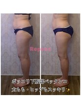 ルポーゼ(Repose)/