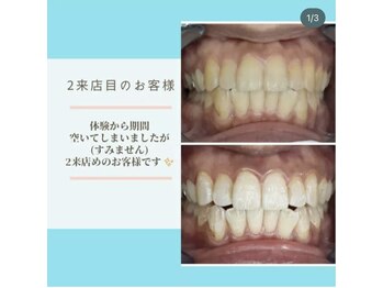 ライトビューティー 本八幡店(LIGHT BEAUTY)/【セルフホワイトニング】