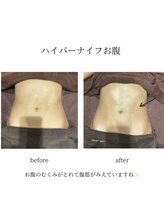 グランツ 小山店/ハイパーナイフお腹