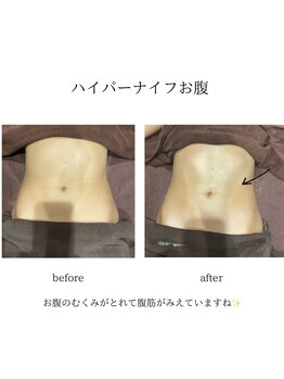 グランツ 小山店/ハイパーナイフお腹