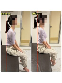 アンティオール 桜木町店/Before→After