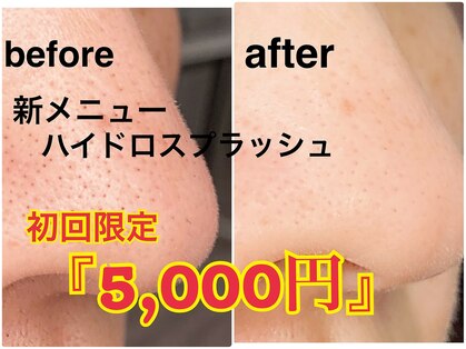 ステラ(STELLA)の写真
