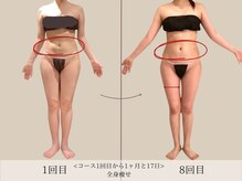 エル 麻布十番(LllL)/【痩身】全身痩せ(インディバ)