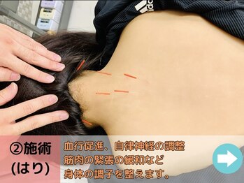 ボディハイエストインターナショナル(Body Highest INT)/手技(はり)