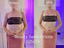 グラツィア 銀座(Grazia)/1回【 ブライダルエステ整体 】