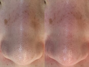 サイセイ(SAISEI)/