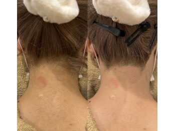 アンビジュ(un bijou)/おめでとうございます♪