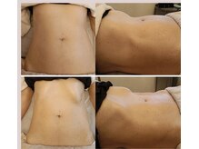 ソワン(soin)の雰囲気(腸もみ×骨盤調整でぽっこりガチガチお腹とさようなら)