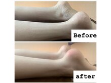 サロンドビジュー(salon de bijou)/ホットストーン×むくみ