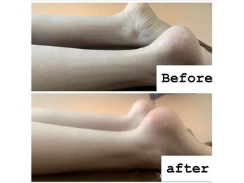 サロンドビジュー(salon de bijou)/ホットストーン×むくみ