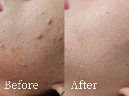 ワン(One)の写真