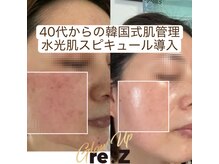 タクボディバランスの雰囲気（くすみ、乾燥、たるみ、40代からの韓国式肌管理。肌育プログラム）