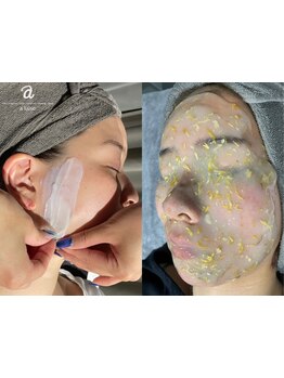 顔脱毛がしたい