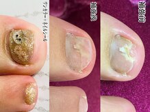 フルール(Fleur)/フットネイル＊