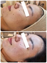 クレイルサロン(Claire salon)/ソフトハーブコース