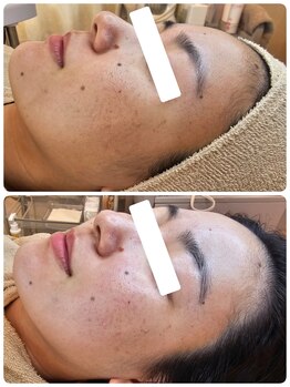 クレイルサロン(Claire salon)/ソフトハーブコース