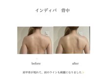 グランツ 小山店/インディバ背中