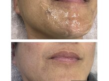 シェルナ(CIELNA)/根強い髭も！！