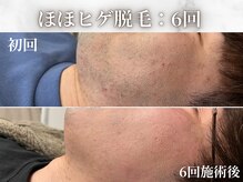 リラクゼーション研究所の雰囲気（ヒゲ、VIOに特化した脱毛機も導入★痛みなく最短でツルツルに！）