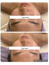 ルピナージュ(Lupinage)/【肌質改善】-小顔　毛穴-