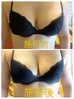 リラックスジュリー/バストケア