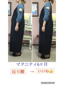 スマイル(smile)/before after 