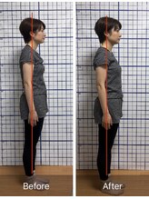 幸鍼灸整体院 武庫之荘院/整体・トレーニング・姿勢変化13