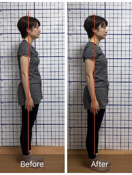 幸鍼灸整体院 武庫之荘院/整体・トレーニング・姿勢変化13