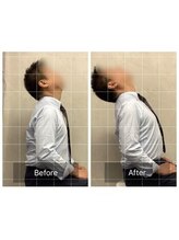 博多おかげ整体院/猫背・巻き肩改善