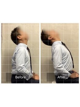 博多おかげ整体院/猫背・巻き肩改善