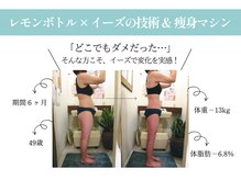 クリニカルエステ イーズ 小倉リバーウォーク北九州デコシティ店の雰囲気（「効果が分からなかった」そんな方こそイーズで変化実感者続出中）