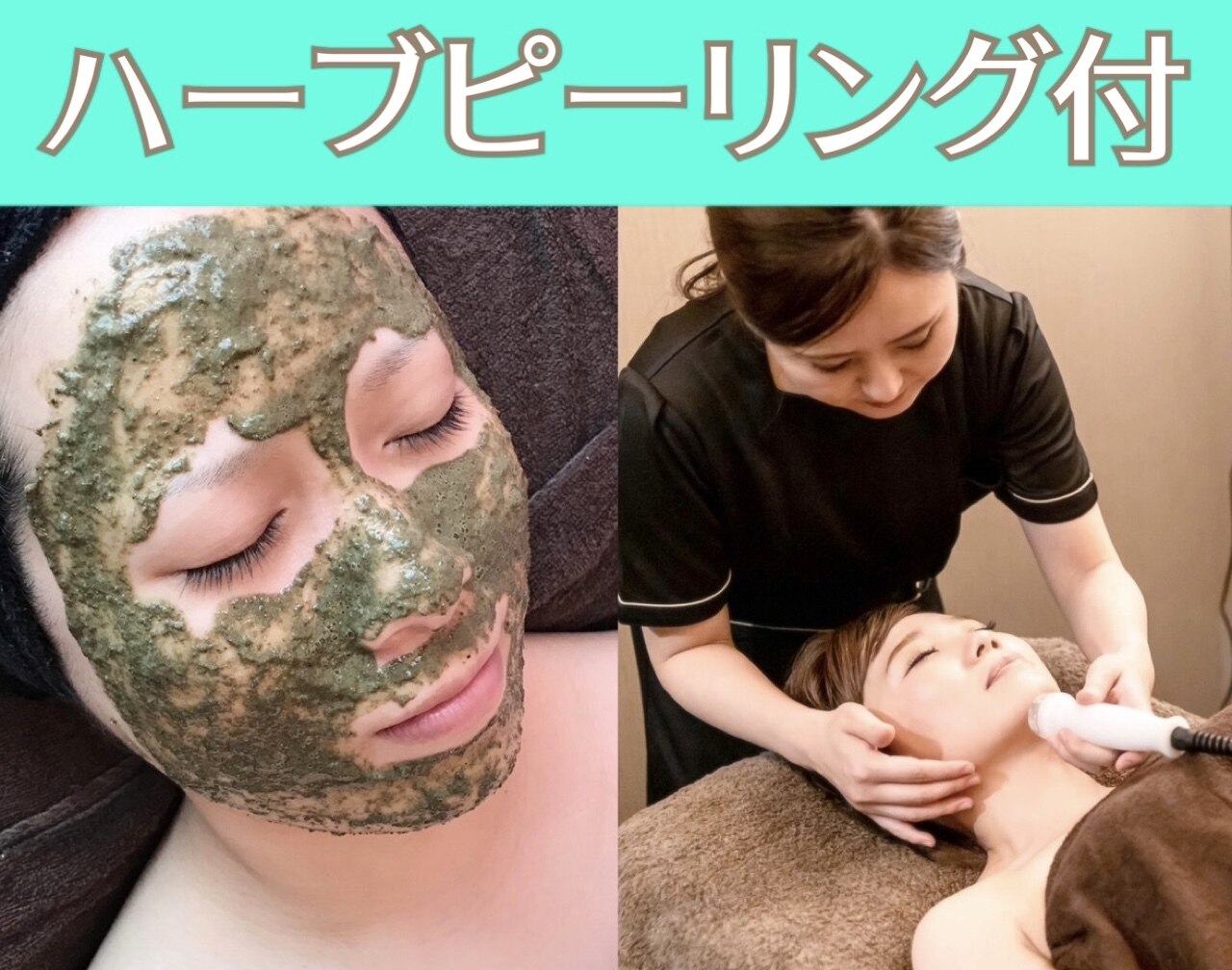 ハーブピーリング 剥離ありに関するエステサロン 美肌ケアサロンiru