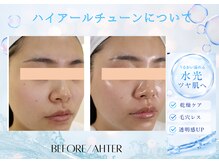 ユアーズ ビューティー(YOURS beauty)/ハイアールチューン