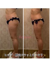 ルポーゼ(Repose)/