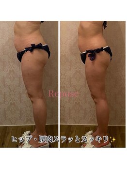 ルポーゼ(Repose)/