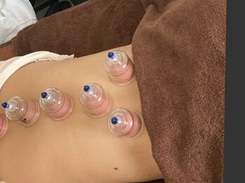 ソレイユ/背中カッピング(オプション)