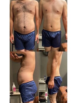 アネル 新都心店(anel)/メンズ脱毛＋ダイエット《那覇》