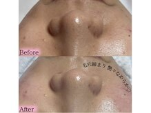 ココカナ(COCOKANA)の雰囲気（フェイシャルワックスで艶々、健やかなお肌に育てていきます。）