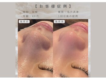 オロラ 西宮店(Aurora)