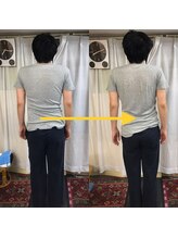 新橋整体グッドラックカイロプラクティック(Good Luck)/姿勢のアンバランスを矯正しに