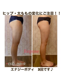 ルポーゼ(Repose)/