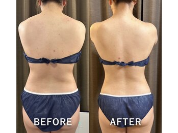 ミント(Mint)/フォースカッター×肩甲骨出し!