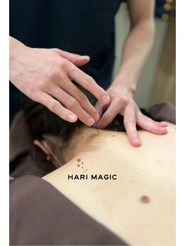 ハリマジック 代官山(HARI MAGIC)/【代官山/鍼灸/美容鍼】