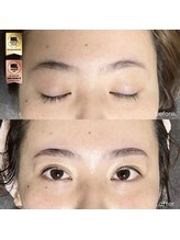 アイリー(IRIE)/ハリウッドブロウリフト