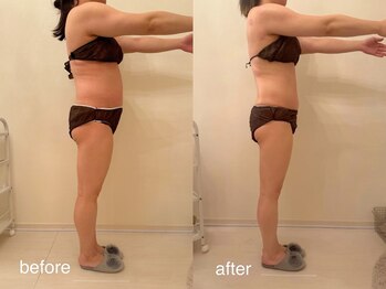 クロレ 浦和店(CLORE)/30代のお客様/12回施術