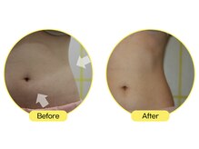 美活ラボ(美活LABO)の雰囲気（レモンボトル★お顔＆BODYピンポイントで脂肪分解）