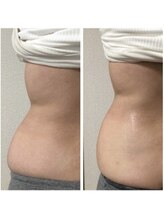 インナーエステ専門店　INNE【イネレ】/ビフォーアフター（後ろ側）