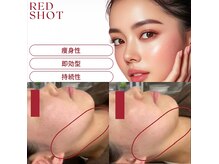 モモン シャルールの雰囲気（当店人気上昇中！RED SHOT脂肪分解で顎頬すっきりリフトアップ♪）