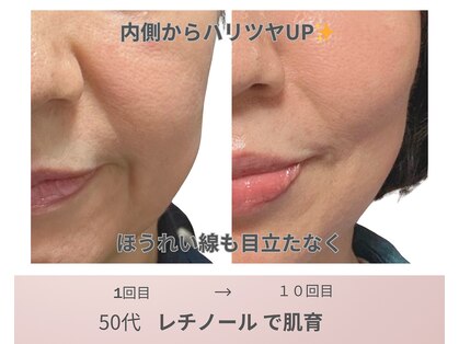 リアン(Lien)の写真